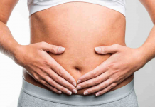 Polipi al colon, abbassare i rischi perdendo peso