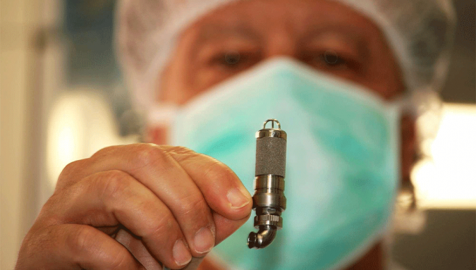 Bimba di 3 anni salvata da un mini cuore artificiale